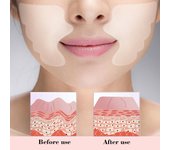 Mascarilla de silicona antiarrugas reutilizable para zona nasolabial y pómulos 2 uds.
