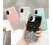 Funda de teléfono de lujo con purpurina brillante para Xiaomi Mi 10, 10T, 10S, 11i, 11T Pro, 11 Lite 5G, funda ultra completa para Redmi Note 11 Pro, 11S for xiaomi mi 10 negro