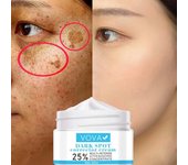 Crema para manchas oscuras de 30ml, crema de eliminación de pigmentos efectiva de extracción Natural de fusión profunda múltiple, belleza 30ml