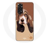 Coque pour Xiaomi Redmi Note 11 4G Basset Hound chien visage