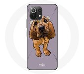 Coque pour Xiaomi Mi 11 Lite Brown Floppy Ears