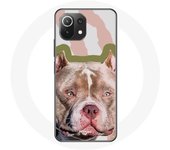 Coque pour Xiaomi Mi 11 Lite Chien de Pitbull marron