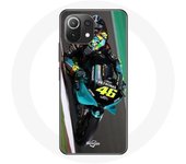 Coque - Valentino Rossi - Xiaomi Mi 11 Lite - Souple - Protection - Mixte