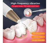 Escalador Dental ultrasónico para dientes, eliminador de cálculo Dental sónico, limpiador de placa Dental sónico, eliminación de piedra Dental oro