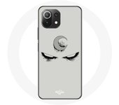 Coque pour Xiaomi Mi 11 Lite Moon Knight Batman Saison 1 Yeux en colère