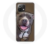 Coque pour Xiaomi Mi 11 Lite Chien Pitbull Blanc gris