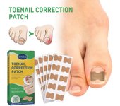 50 unids/caja pegatina para uñas encarnadas, Kit de herramientas para parches de corrección de uñas, tratamiento de uñas para pies amarillo