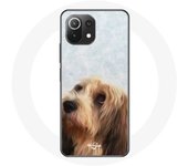 Coque pour Xiaomi Mi 11 Lite Blonde Vulnerable native breeds