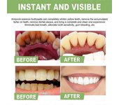 10-30x Pasta de dientes con ampolla, Suero dental con ampolla, Pasta de dientes con esencia de ampolla 20pcs