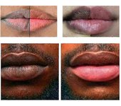 1-3x Bálsamo Exfoliante Aclarador de Labios Aclara los Labios Hialurónico 20g 2pcs