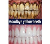 Blanqueamiento de los dientes espuma mousse elimina la placa negra amarillo cigarrillo dientes de café Comprar 5 y obtener 5 gratis