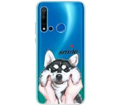 For Phone Case Huawei P20 lite 2019 Case Soft TPU Silicone Back Cover For Huawei P20 lite 2019 GLK-LX1 GLK-LX2 GLK-LX3 Case Capa