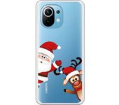 Carcasa para Xiaomi Mi 11 - Santa Claus Asomado