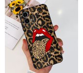 For Motorola Moto G24 Case XT2423-1 Fashion Painted Soft Silicone Shockproof Cover For Moto G34 XT2363-2 Bumper G 34 G 24 Fundas