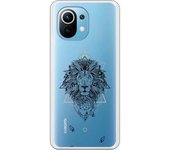 Funda compatible con Xiaomi Mi 11 - Leon Trazos