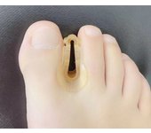 2Pairs Gel Feet Care Toe Separator Hallux Valgus Bunion Corrector Hammer Toe Straightener Foot Pain Relief Orthopedic Pedicure