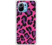Funda original compatible con Xiaomi Mi 11 - Textura Leopardo Rosa